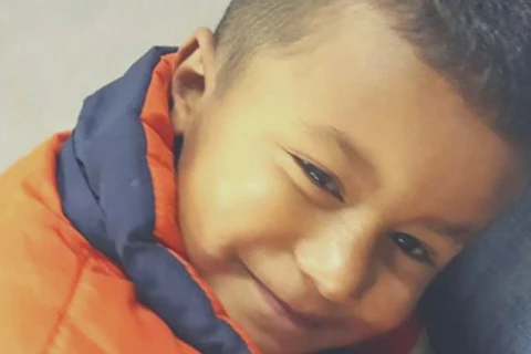 Criança que teve 40% do corpo queimado após explosão morre no hospital