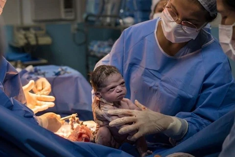 Recém-nascida faz cara "emburrada" e imagem viraliza nas redes sociais