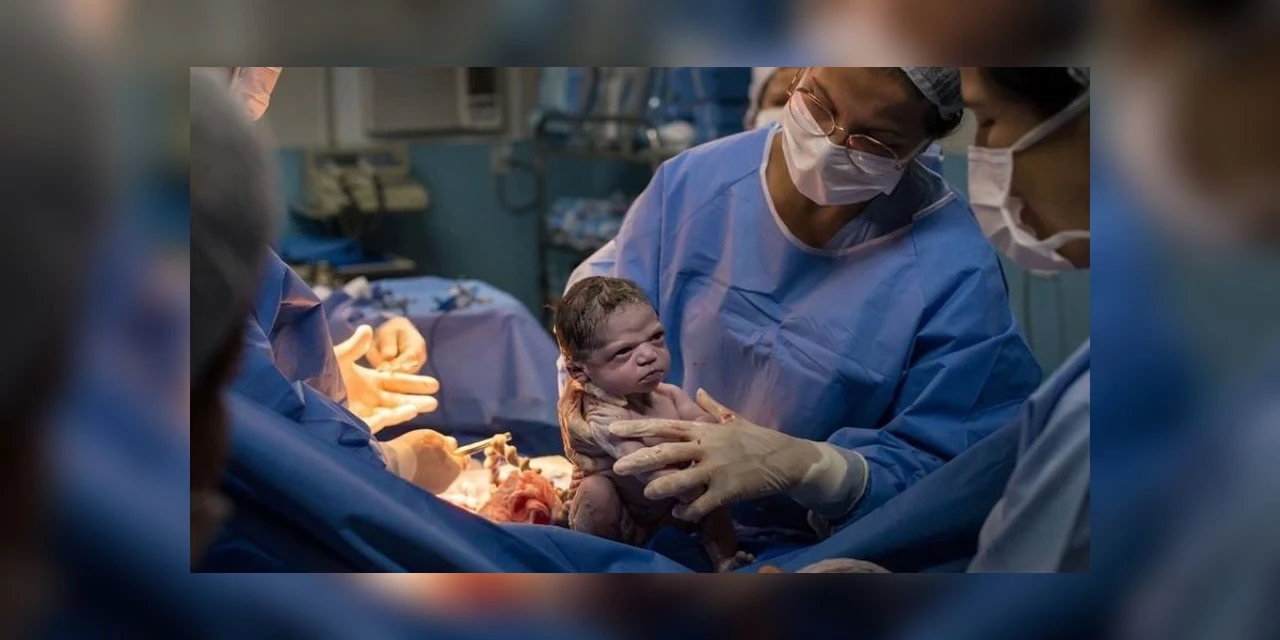 Recém-nascida faz cara "emburrada" e imagem viraliza nas redes sociais