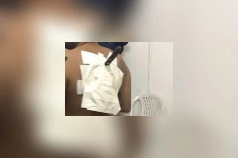 Rapaz foge com faca cravada nas costas após ser atacado em Almirante Tamandaré