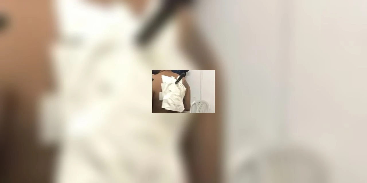 Rapaz foge com faca cravada nas costas após ser atacado em Almirante Tamandaré