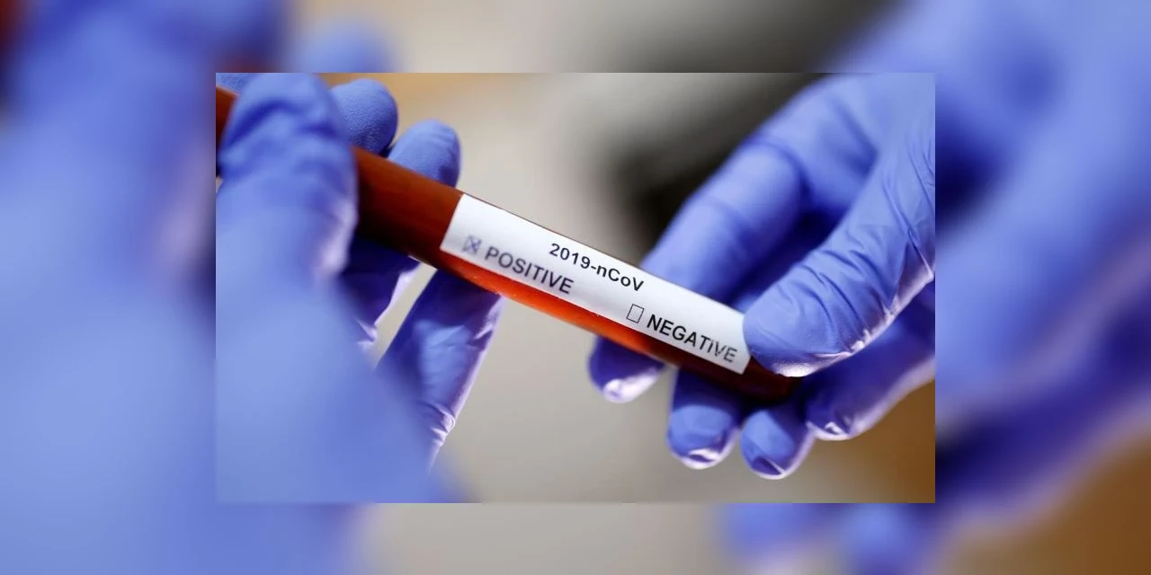 Sobe para três numero de casos confirmados de coronavírus em Ponta Grossa