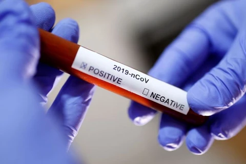 Ponta Grossa registra 13º caso positivo de covid-19 na cidade