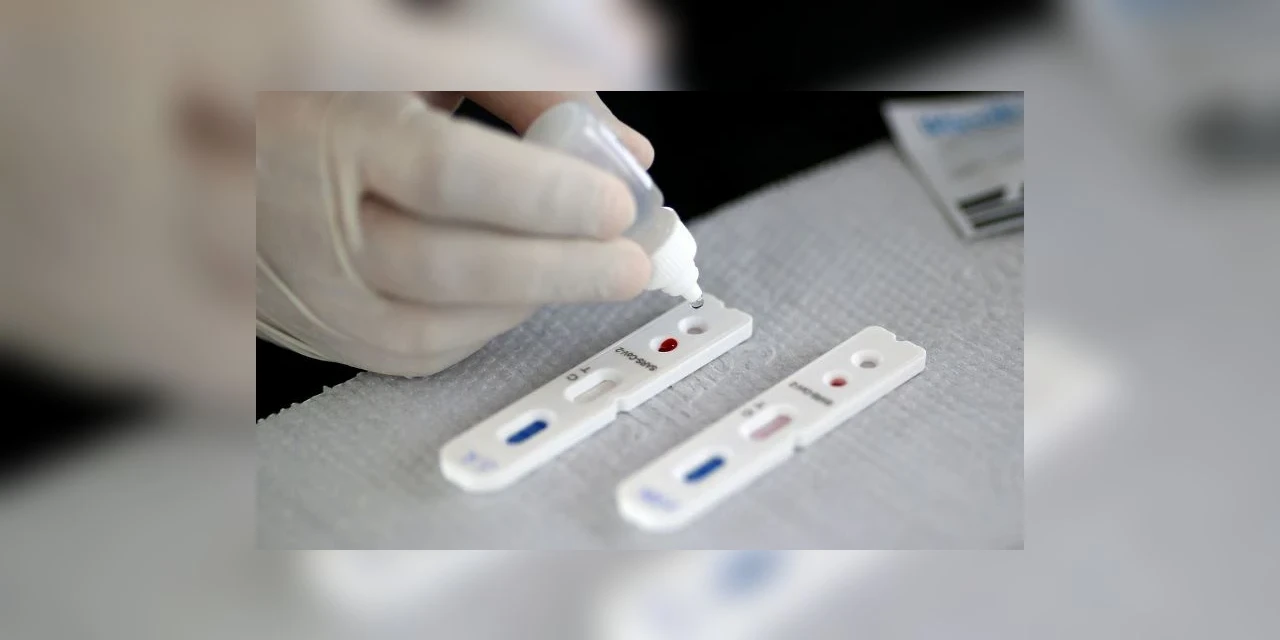 Pesquisadores de Israel descobrem anticorpo para o coronavírus