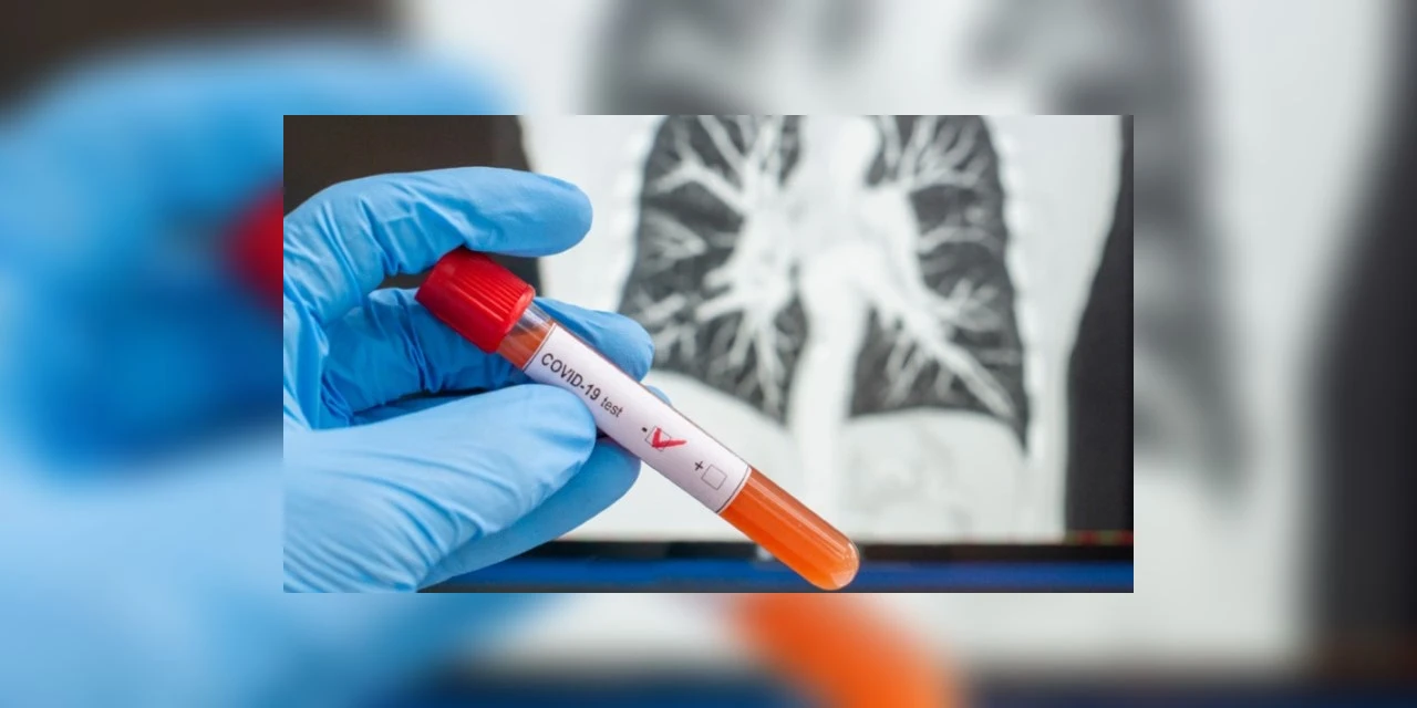 Saúde registra novos casos de coronavírus em Ponta Grossa