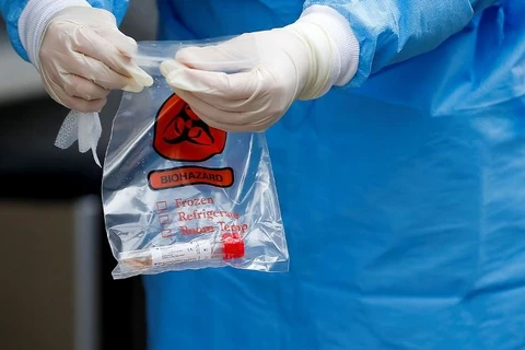 Ponta Grossa registra mais 2 casos positivos de covid-19 e 44 recuperados