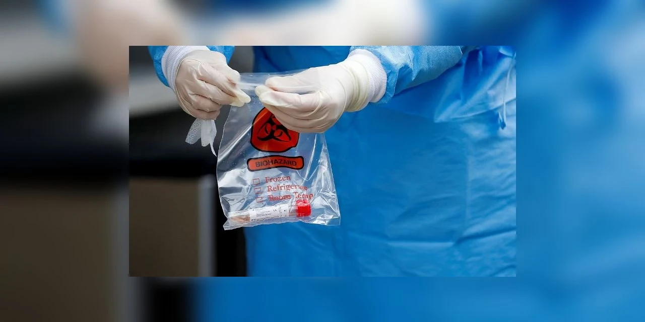 Ponta Grossa registra mais 2 casos positivos de covid-19 e 44 recuperados