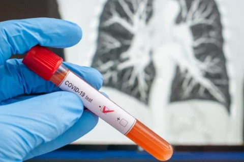 Ponta Grossa registra 11º óbito por coronavírus