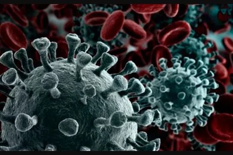 PG registra 76º óbito por covid na cidade