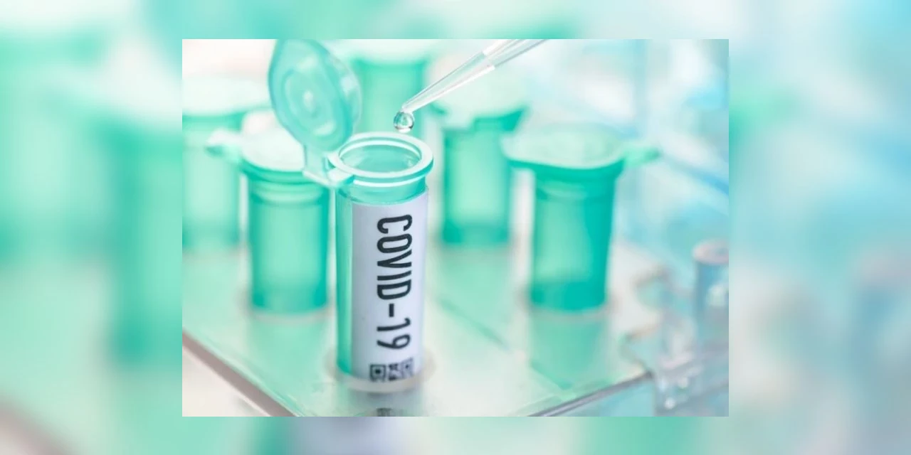 Covid-19: Brasil registra 1,1 mil mortes e 58,7 mil casos em 24 horas