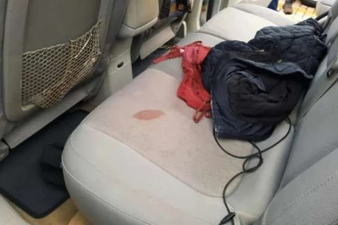 Adolescente de 16 anos morre em motel após sofrer hemorragia no Paraná