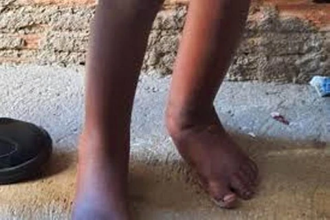 Imagens fortes; PM resgata criança que vivia acorrentada dentro de Barril em Campinas