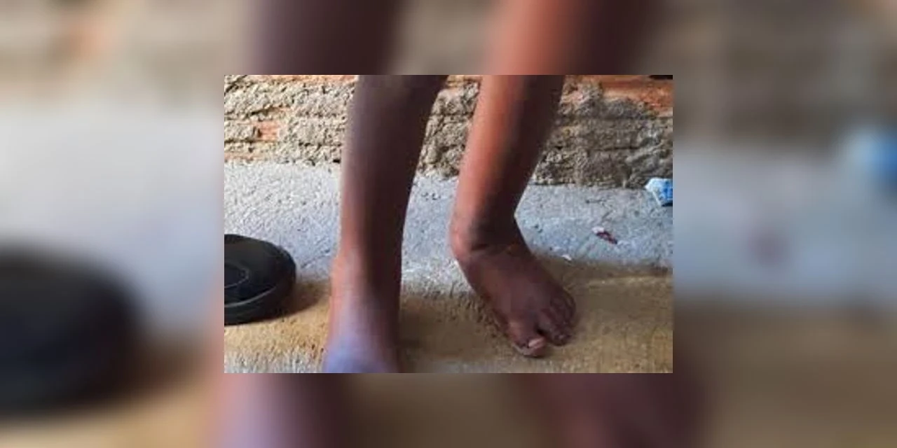 Imagens fortes; PM resgata criança que vivia acorrentada dentro de Barril em Campinas