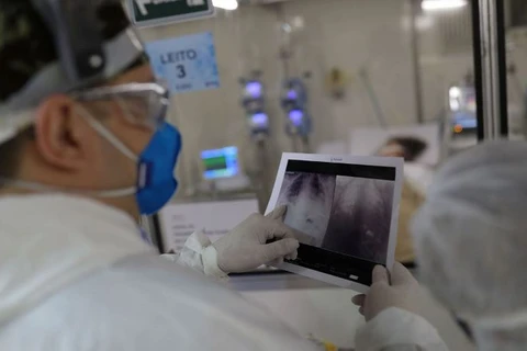 País tem mais de 1,8 mil óbitos pela covid em 24 horas