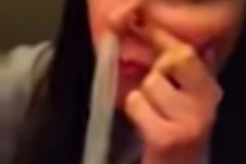 Mulher com suspeita de tuberculose descobre ter camisinha no pulmão