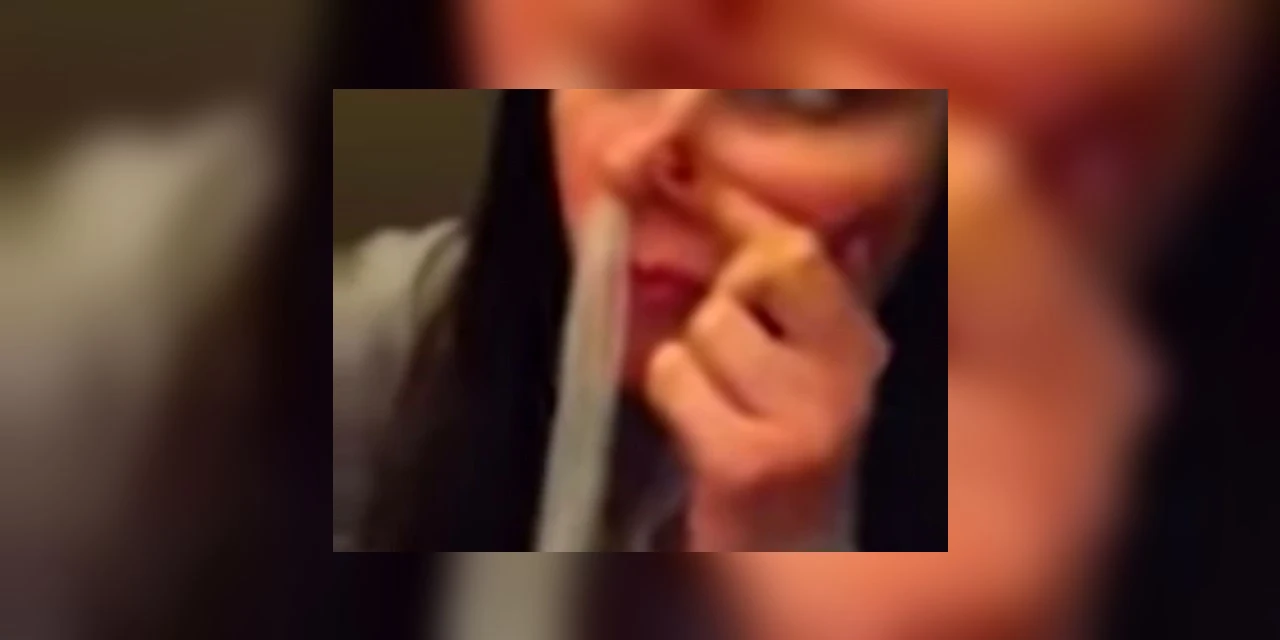 Mulher com suspeita de tuberculose descobre ter camisinha no pulmão