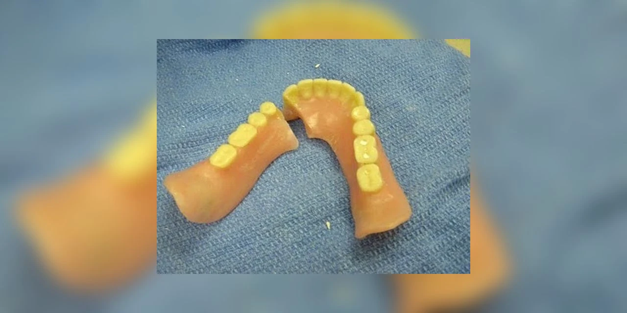 Briga de bar termina com homem agredido e dentadura quebrada em Prudentópolis.