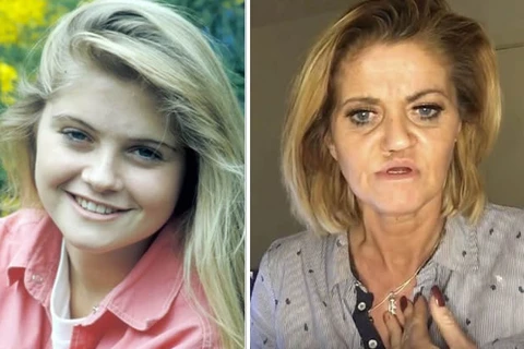 Atriz Danniella Westbrook faz cirurgias para reparar rosto corroído por uso de cocaína