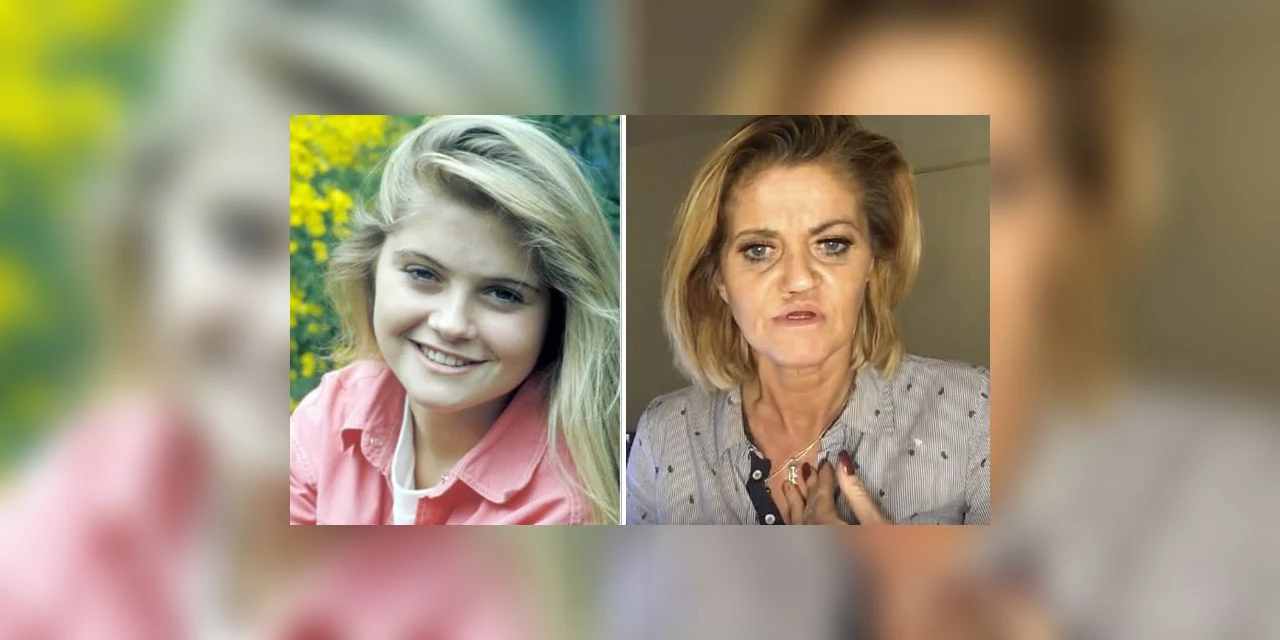 Atriz Danniella Westbrook faz cirurgias para reparar rosto corroído por uso de cocaína