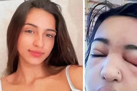Jovem de 15 anos morre por infecção após colocar piercing escondido da família