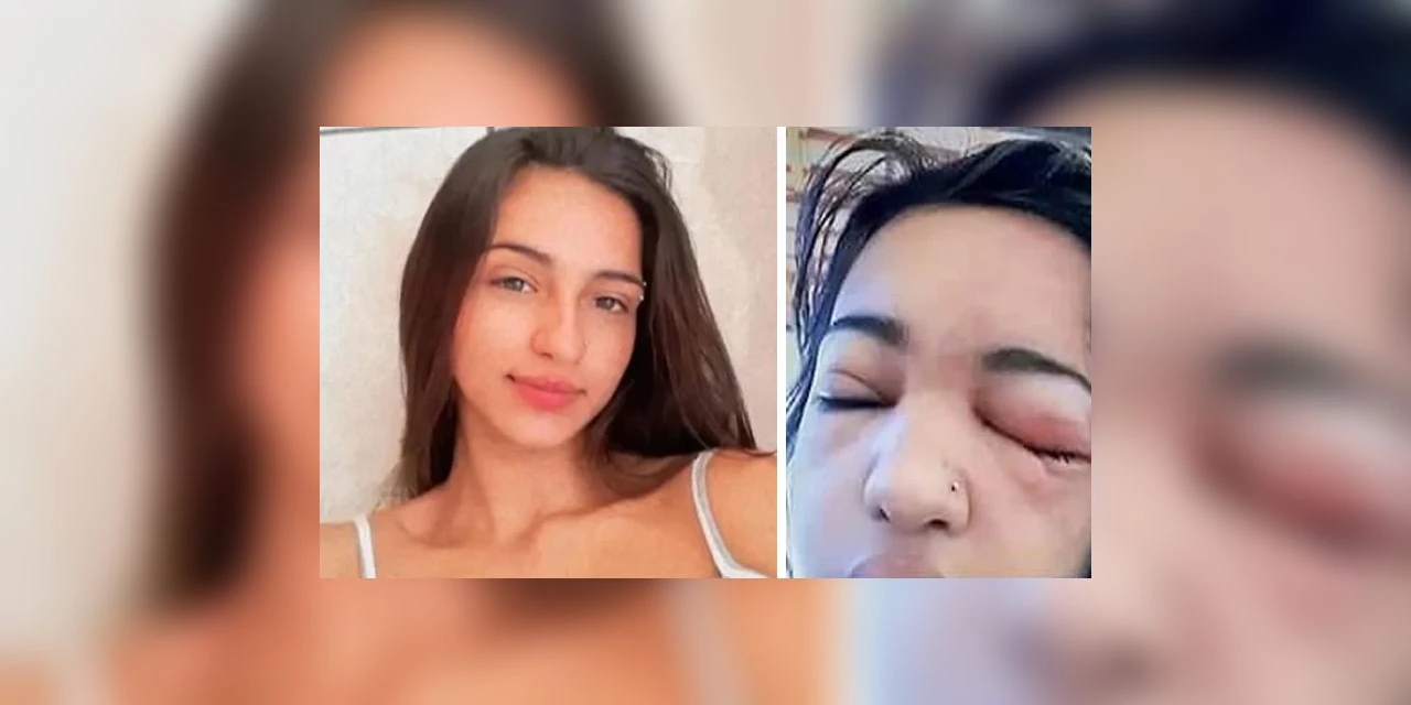 Jovem de 15 anos morre por infecção após colocar piercing escondido da família