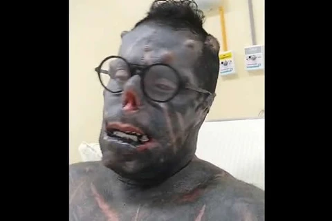 "Diabão" agradece orações após passar por cirurgia e receber alta de hospital