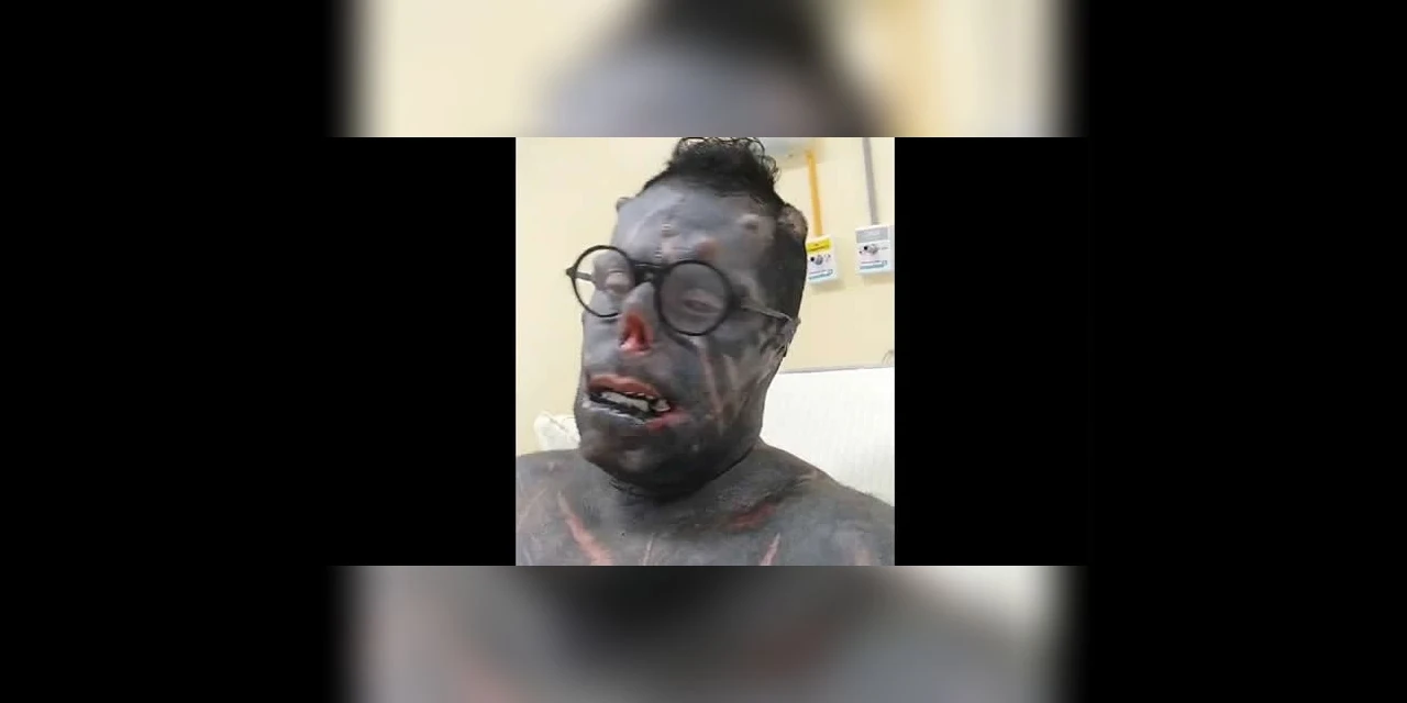 "Diabão" agradece orações após passar por cirurgia e receber alta de hospital