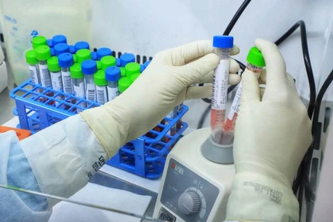 Nono caso da variante Delta é confirmado no Paraná; paciente é de São José dos Pinhais