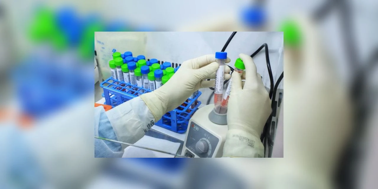 Nono caso da variante Delta é confirmado no Paraná; paciente é de São José dos Pinhais