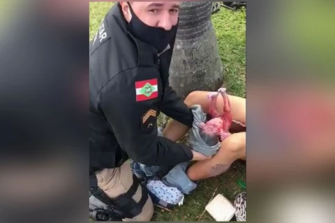 Policiais rodoviários realizam parto de emergência em SC; veja!