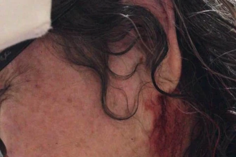 MPPR denúncia homem que agrediu e tentou atear fogo na casa com a ex-namorada dentro