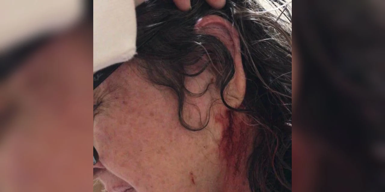 MPPR denúncia homem que agrediu e tentou atear fogo na casa com a ex-namorada dentro