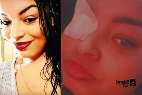 Mãe que está ficando cega e precisa de tratamento ganha vaquinha. Ajude!