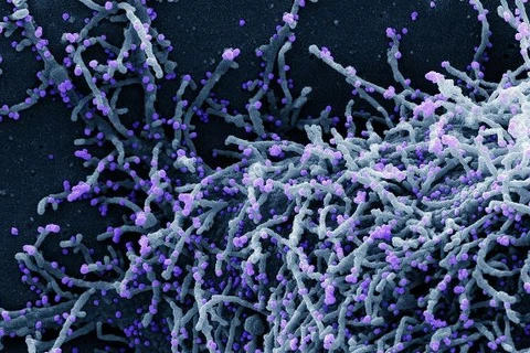 Parece noticia velha, mas não é; nova onda de covid-19 atinge a Europa