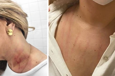 Vereadoras entram no tapa em banheiro da Câmara de SP