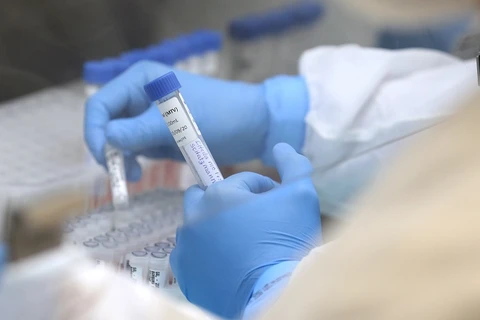 Saúde divulga mais 481 casos e 28 óbitos de H3N2 no Paraná