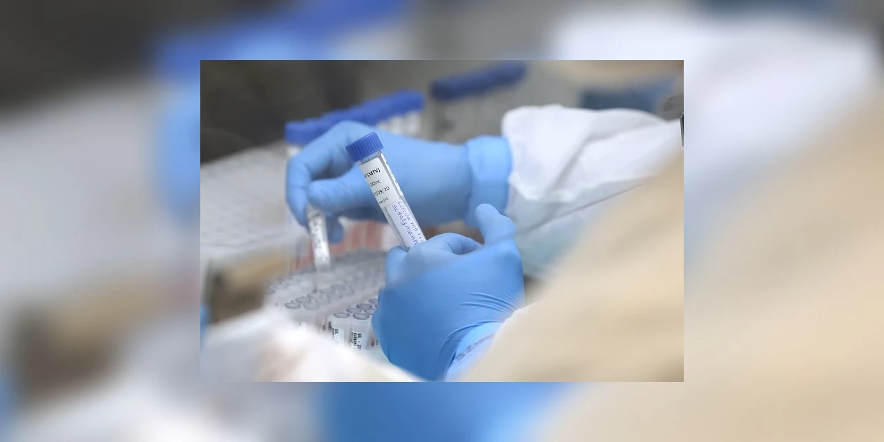 Saúde divulga mais 481 casos e 28 óbitos de H3N2 no Paraná