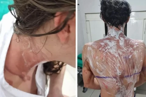 Trote na UFPR deixa cerca de 20 alunos com queimaduras; 4 pessoas foram presas