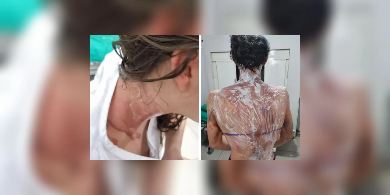 Trote na UFPR deixa cerca de 20 alunos com queimaduras; 4 pessoas foram presas