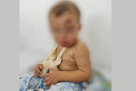 Mãe é presa suspeita de torturar o próprio filho de apenas 2 anos em Prudentópolis