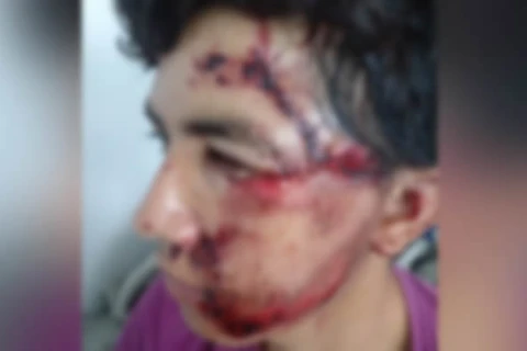 Pai de menino que morreu atropelado em Reserva pede justiça; motorista fugiu do local e esta foragido