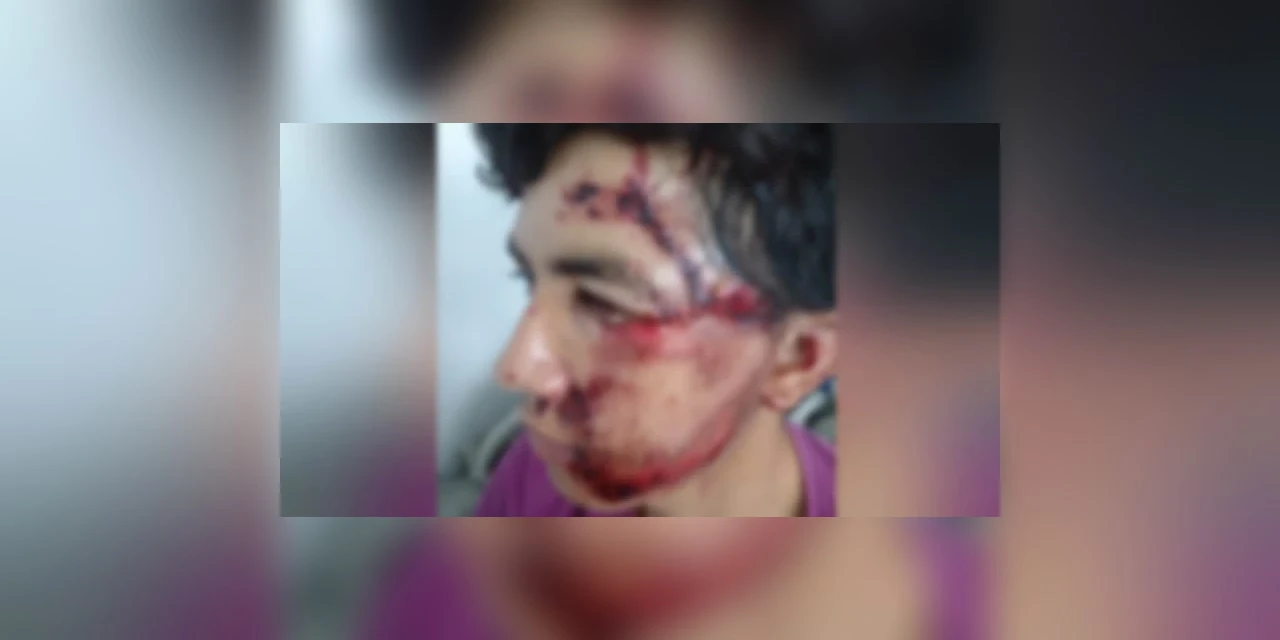 Pai de menino que morreu atropelado em Reserva pede justiça; motorista fugiu do local e esta foragido