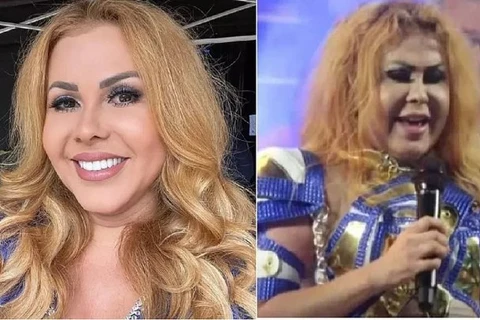 Joelma é internada após receber diagnóstico de esofagite, gastrite e um edema