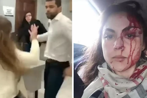 Justiça decreta prisão de procurador que espancou sua chefe de trabalho