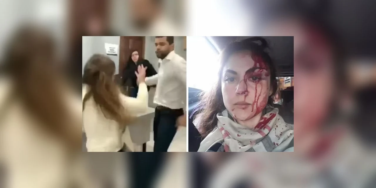 Justiça decreta prisão de procurador que espancou sua chefe de trabalho