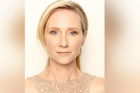 Anne Heche morre aos 53 anos após grave acidente de carro