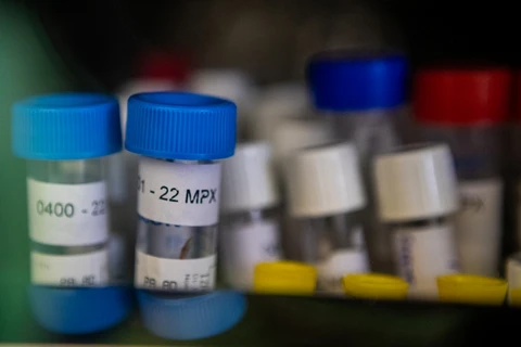 Saúde confirma quatro novos casos de Monkeypox no Paraná