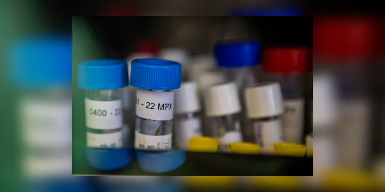 Saúde confirma quatro novos casos de Monkeypox no Paraná