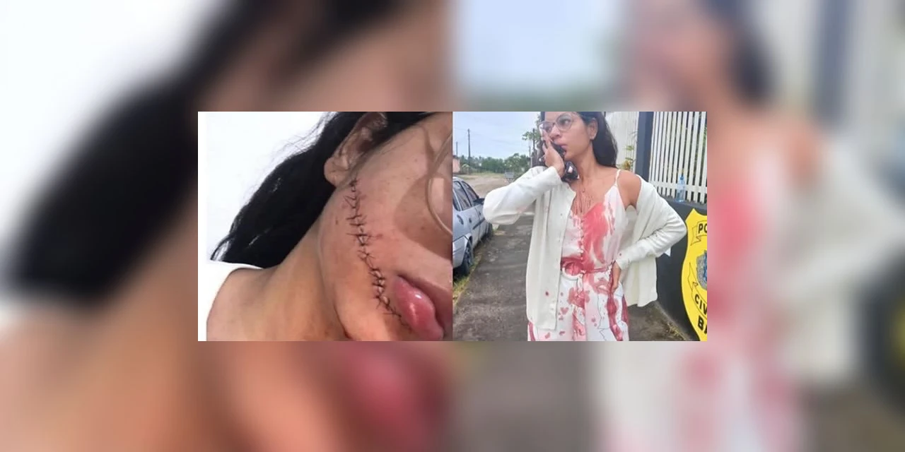 Vídeo mostra momento em que jovem tem rosto cortado durante viagem de ônibus; Assista