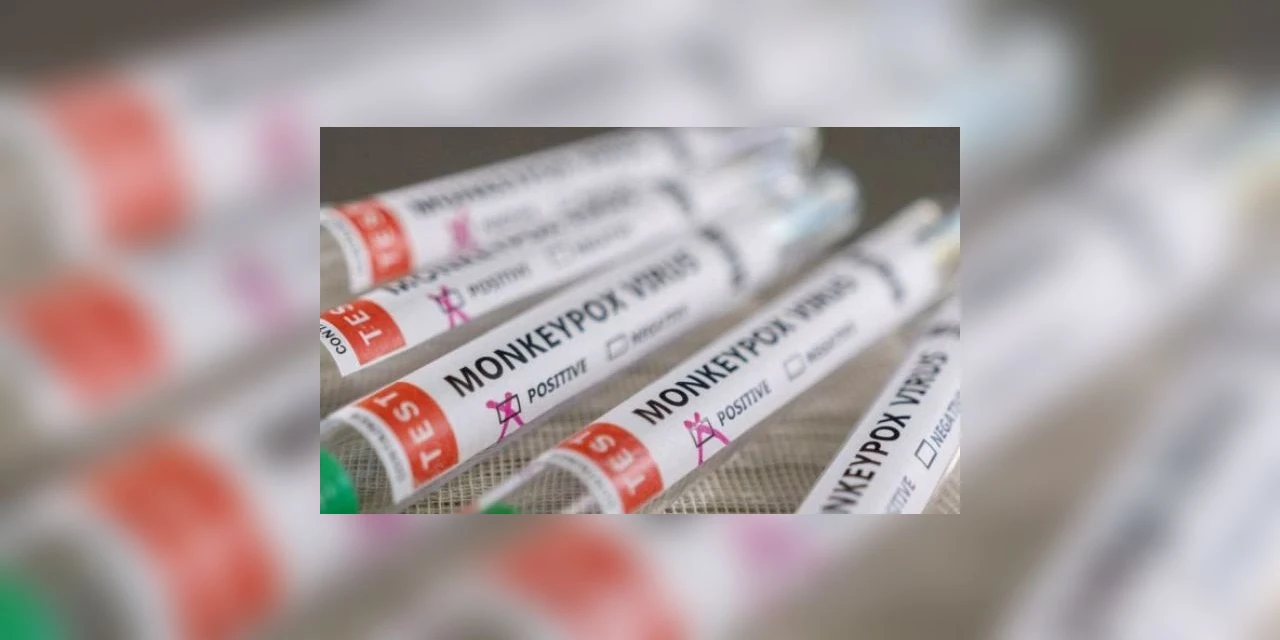 Secretaria da Saúde confirma cinco novos casos de Mpox no Paraná